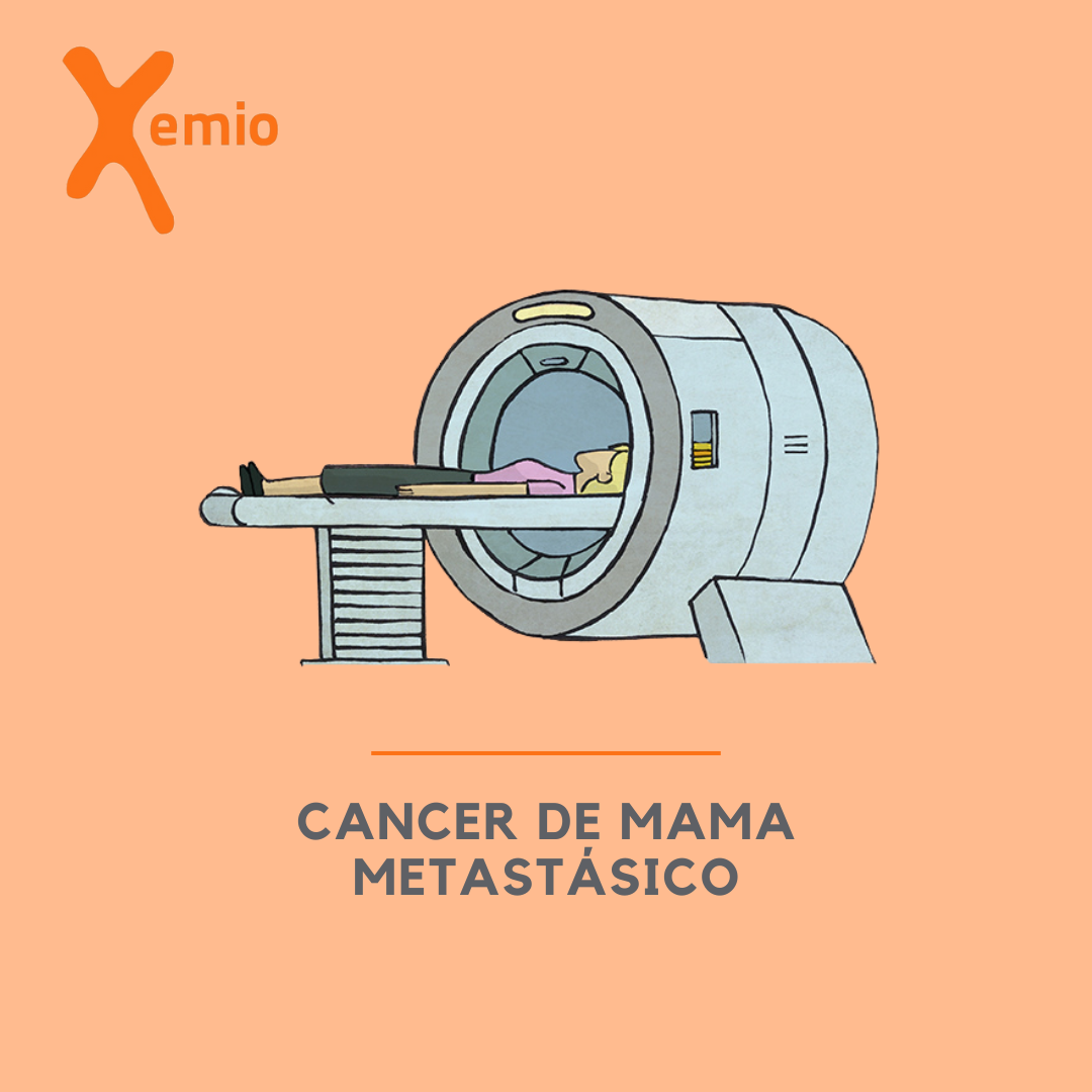 Cáncer de mama metastásico