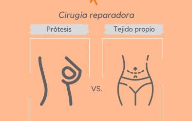 Prótesis mamaria vs. Tejido propio